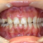 teeth