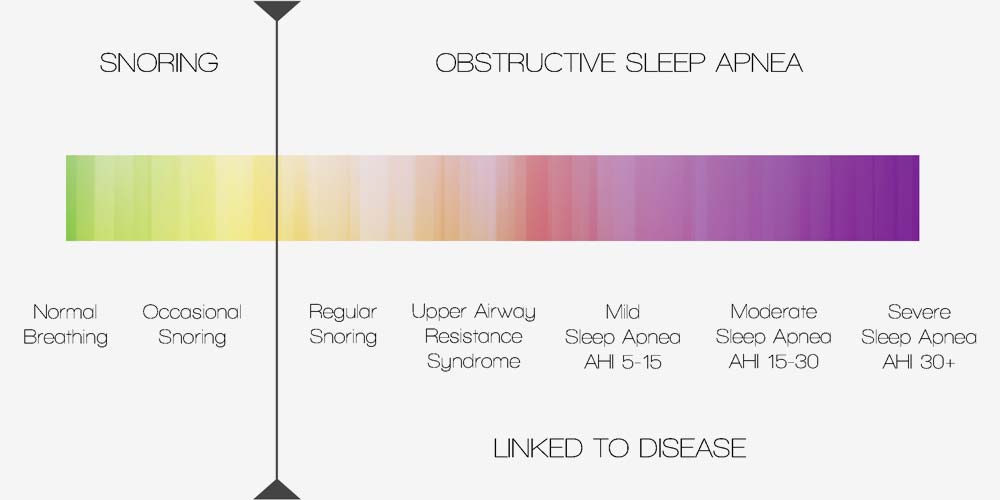 snoring or sleep apnea chart